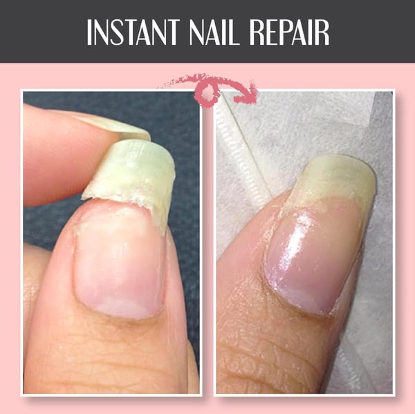 Gel réparateur pour ongles NailEssence™