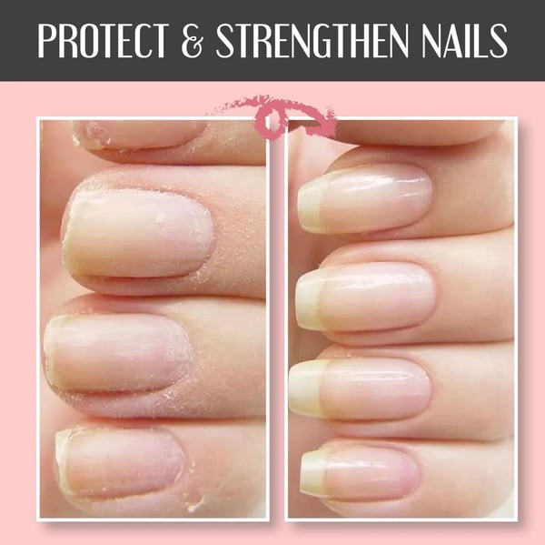 Gel réparateur pour ongles NailEssence™
