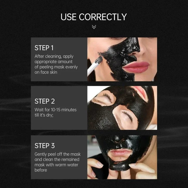 Blackhead remover acne treatment mask