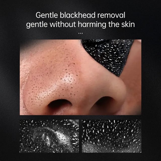 Blackhead remover acne treatment mask