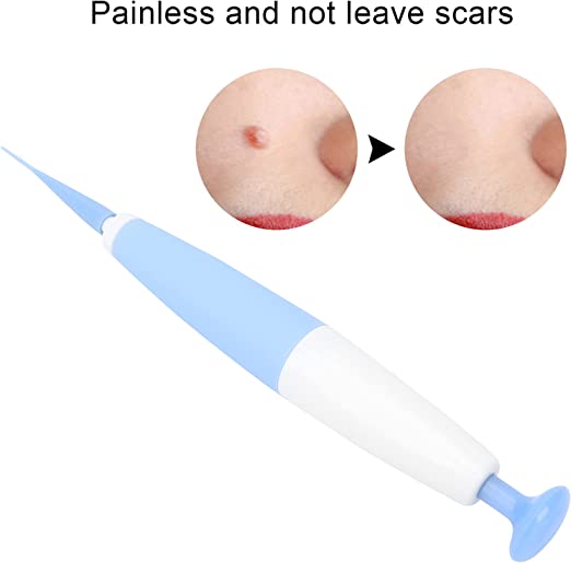 Skin Tag Removal Kit™