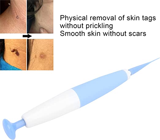 Skin Tag Removal Kit™