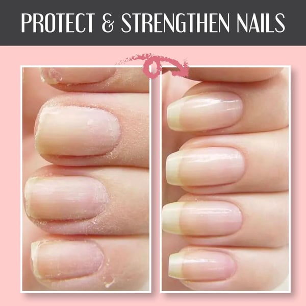 NailEssence™ Nail Repair Gel